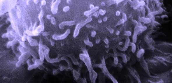 Electron microscopic image of a single human lymphocyte. 