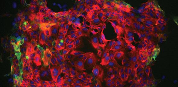 Breast cells grown in the laboratory for research on which cells in the breast form tumours