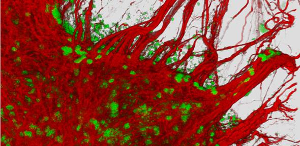 3D image of human neurons in a dish