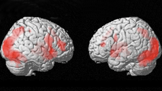 Brain imaging