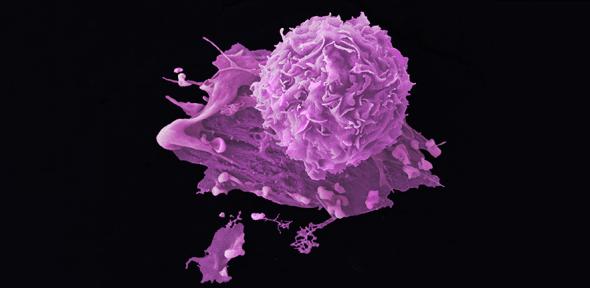 Breast cancer cells