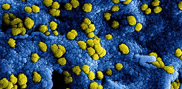 Close-up of virus molecule