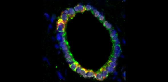 Cholangiocyte organoids reconstruct human bile duct
