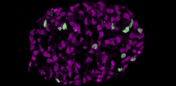 Embryoid at start of appearance of SOX17 positive cells (green cells), which depict birth of human germ cell lineage