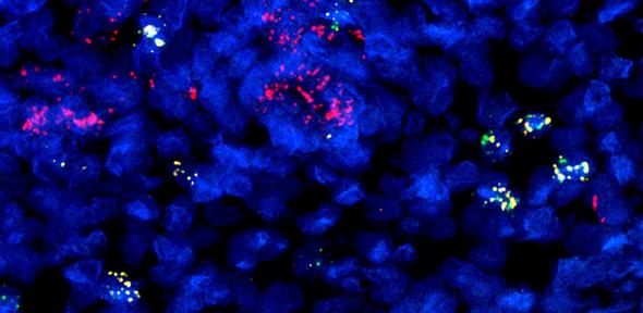 Developing immune cells (B cells) from prenatal gut tissue