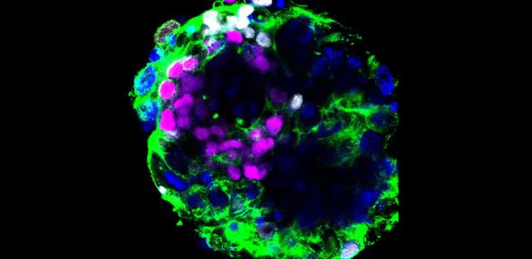 Human embryo cultured in vitro