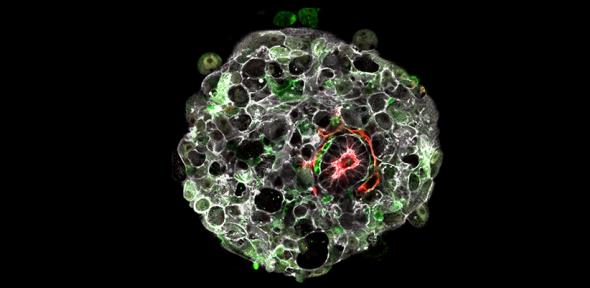 Human embryo in the lab 9 days after fertilisation.