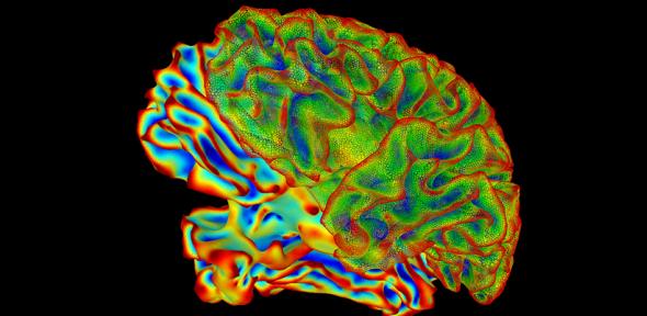 SumaLateral Whole Brain Image