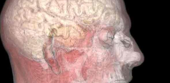 Magnetic resonance image of the mouth, ear and brain