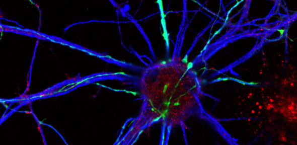 Neurons, confocal fluorescence microscopy
