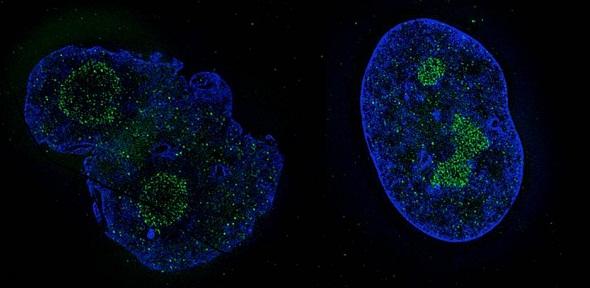 Cell nucleus before and after treatment with Remodelin