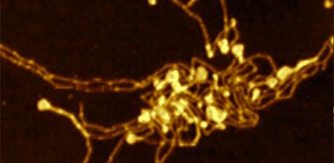 Image of “amyloid fibrils”; thread-like structures which form after the protein alpha-synuclein aggregates. Plaques (protein deposits) consisting of this protein have been found in the brains of Parkinson ’s Disease patients and linked to disease.
