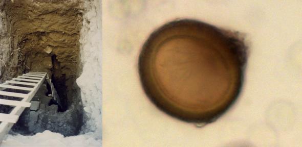 Right: excavation deep down into the latrine by the Ecole Biblique de Jerusalem. Left: Taenia tapeworm egg in the latrine indicating either pork or beef tapeworm. 