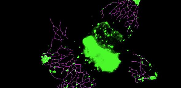 Inducing lysosome motion with light leads to a rapid and significant extension of ER network. 