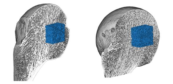 Hunter-gatherer bone mass (left) compared with agriculturalist bone mass (right) 
