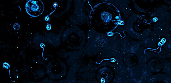 Stylised image of swimming sperm cells