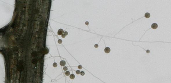 This microscopic image shows the spores and hyphae of 'friendly' arbuscular mycorrhizal fungus interacting with a plant root.