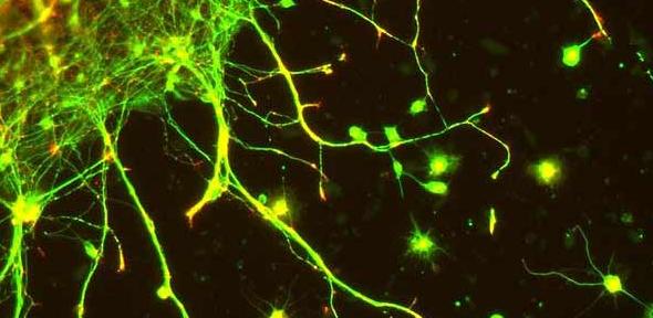 Neurons, in vitrio colour!