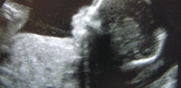 ultrasound scanning