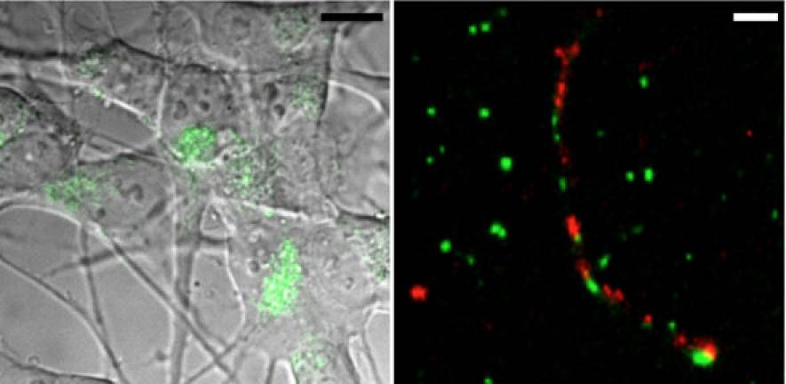 Left: Neuronal cells have ingested Tau protein, which appears in green (scale bar: 10 μm). Right: Optical super-resolution microscopy reveals that ingested protein (red) causes internal protein (green) to form fibrillar aggregates (scale bar: 500 nm).