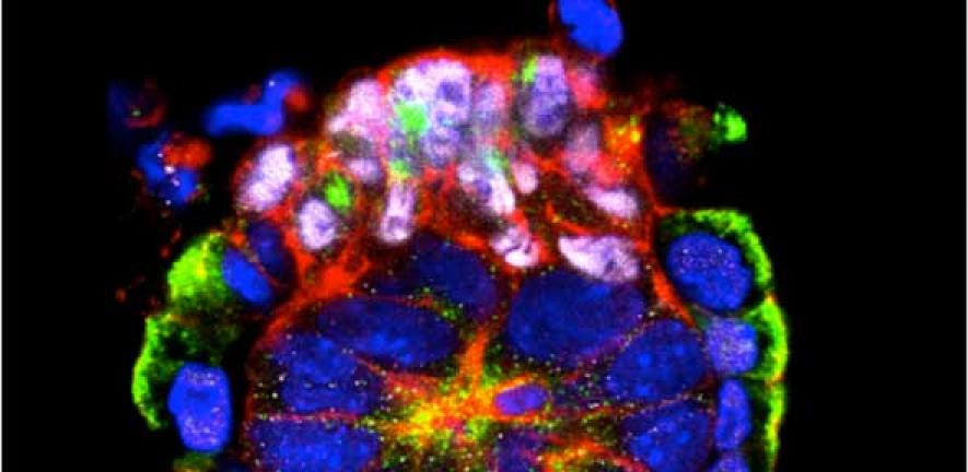 The mouse embryo's own stem cells organise themselves into a rosette-like arrangement as a pre-requisite for laying the foundations for the body when the embryo would implant into the uterus.