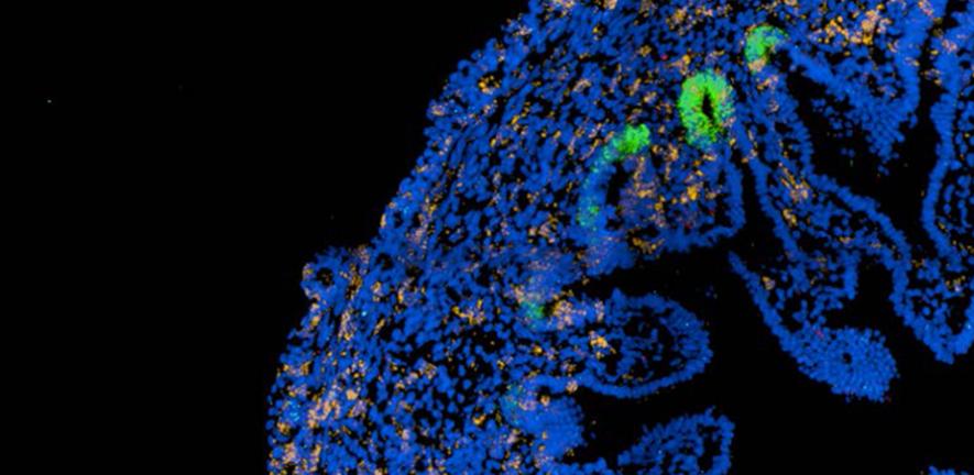 Emerging intestinal villi with stem cells (green) supporting their growth