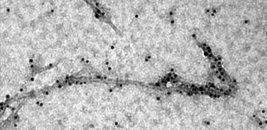 Transmission electron microscopy image showing a molecular chaperone (the black dots) binding to thread-like amyloid-beta (Aβ42)