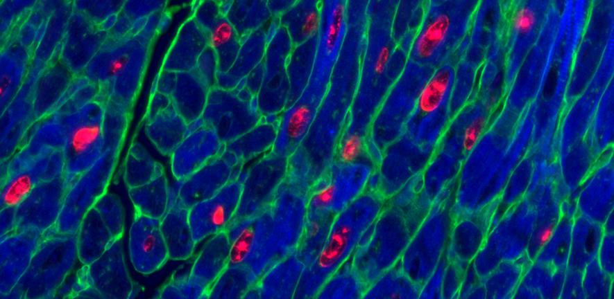 Adult mouse heart muscle cells (blue) after activation of both proteins vital for cell replication. Red shows cells replicating, green marks cell membrane.