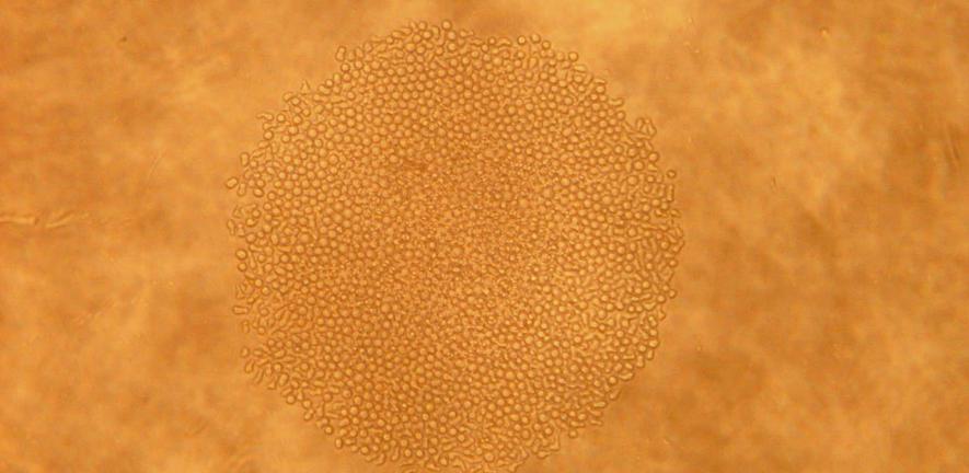 A small colony of cells derived from a single blood stem cell.  Hundreds of such colonies were assessed for their proliferation kinetics and blood cell types produced.  