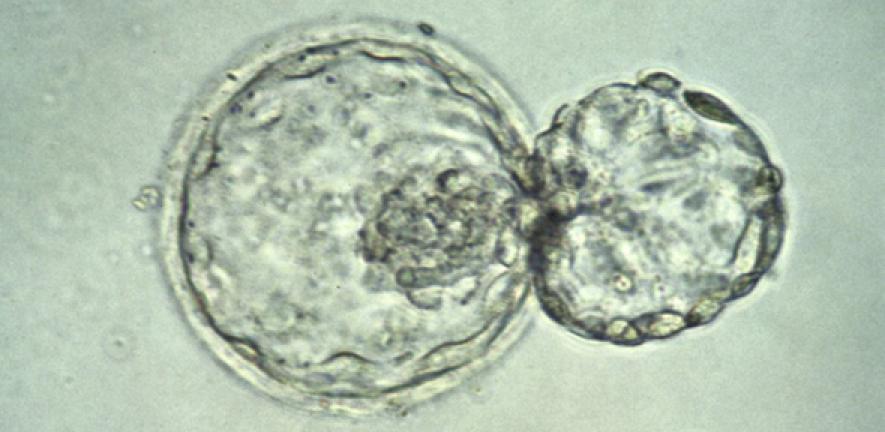 A human embryo at the blastocyst stage, about six days after fertilization, viewed under a light microscope.
