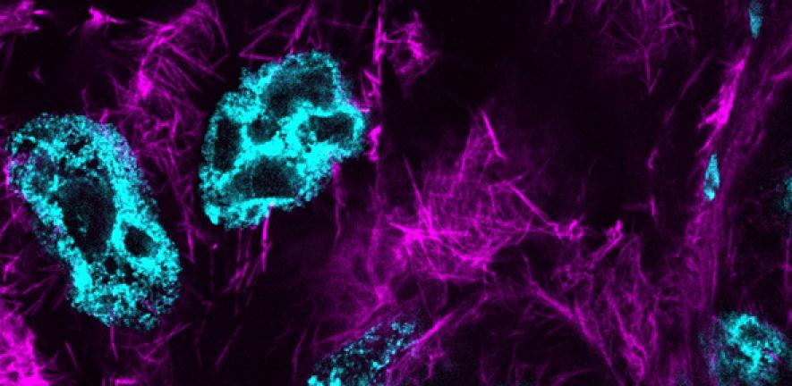 Actin cables in Drosophila nurse cells during late-oogenesis. At this stage, nurse cells die and extrude their cytoplasm into the developing oocyte.