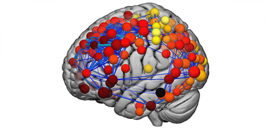 The brain’s structural network. The hubs of this network continue to develop during adolescence.