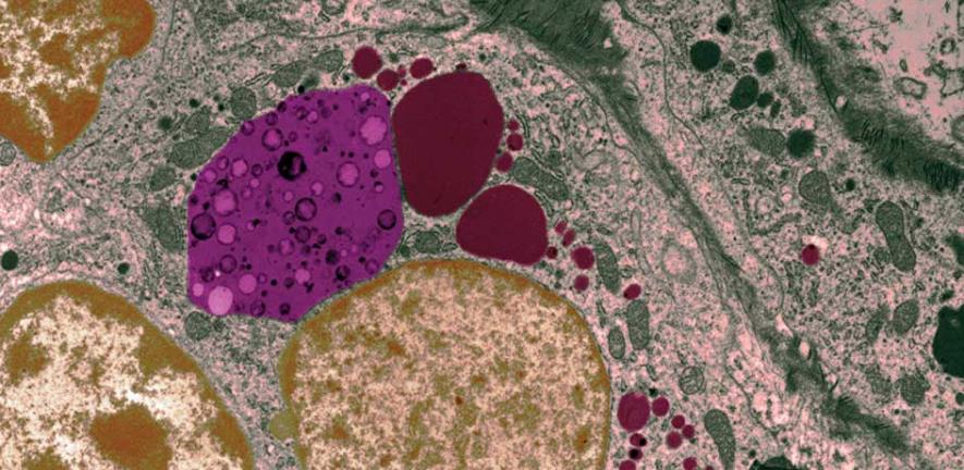 Molecular sacs of debris (pink) are delivered to the lysosome (dark red)