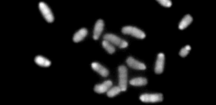 Partial view of haploid chromosome set 