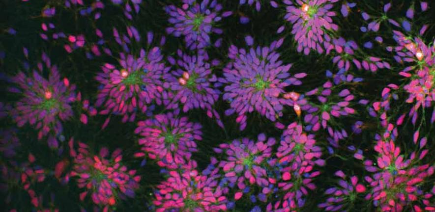 Rosettes of human, patient-specific neural stem cells