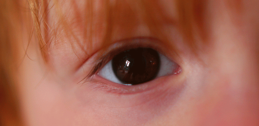 childs eye