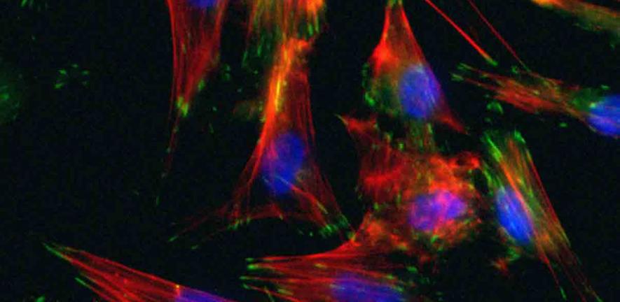 smooth muscle cells