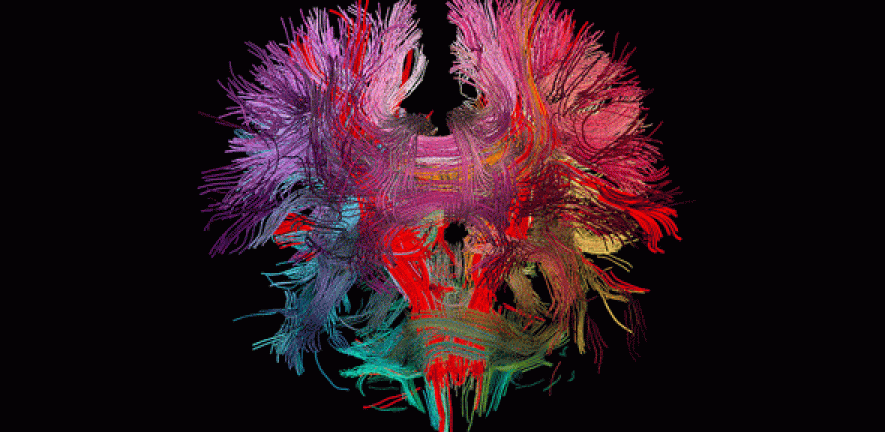Neural Connections In the Human Brain