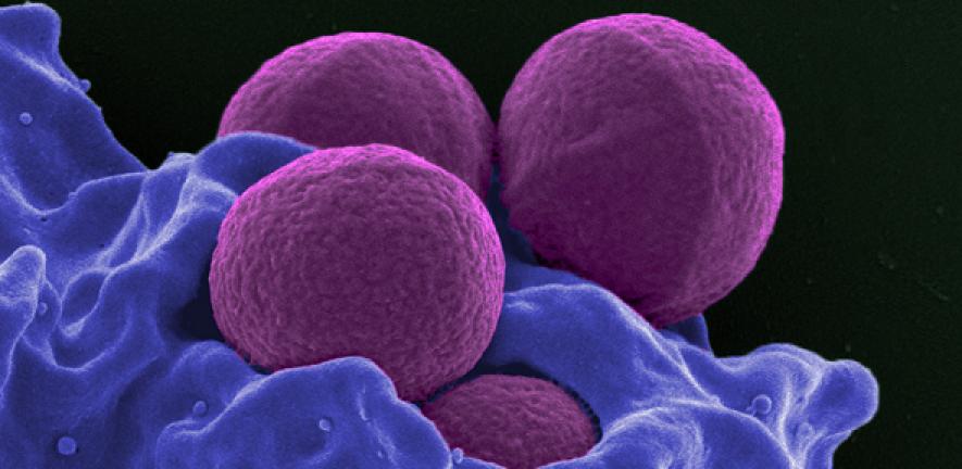 Methicillin-Resistant Staphylococcus aureus