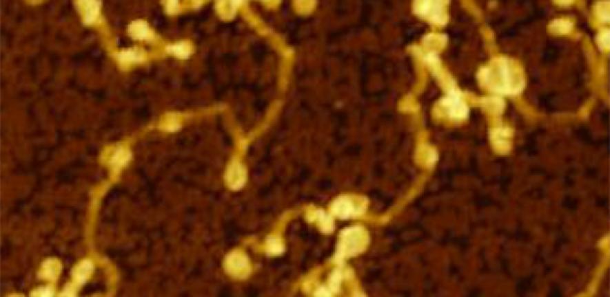 Detail of an atomic force microscopy image which shows amyloid fibrils of alpha-synuclein grown out of synthetic lipid vesicles 