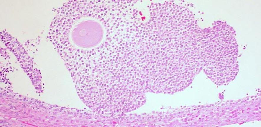 Ovum in Cumulus Oophorus, Human Ovary