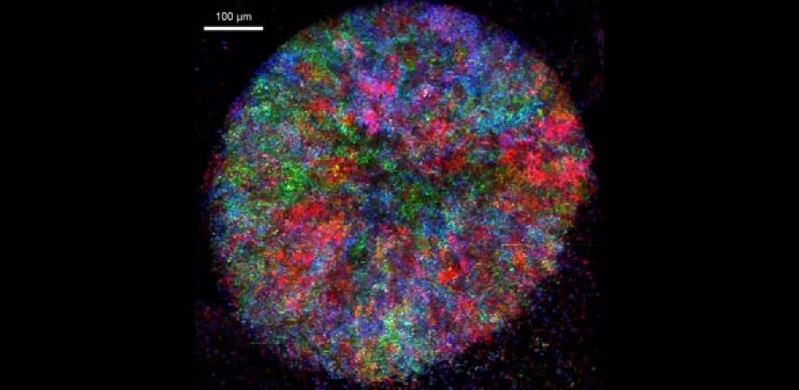 Metabolic cooperation in a social Baker’s yeast community. Pictured is a two-day old yeast community that grows as a colony. Different colours indicate cells producing and consuming different metabolites and nutrients.