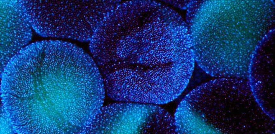 Xenopus laevis oocytes