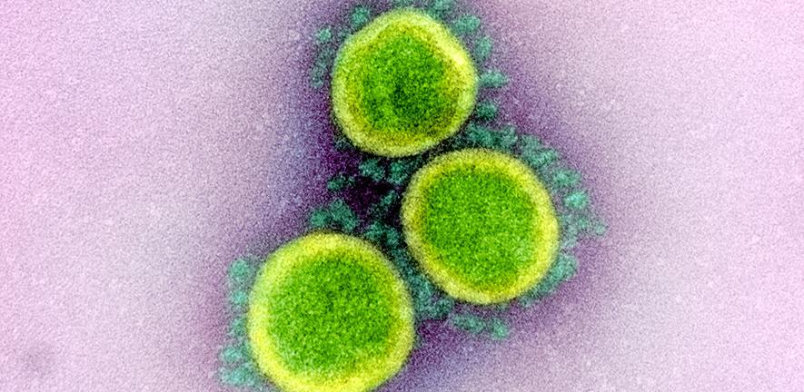 Transmission electron micrograph of SARS-CoV-2 virus particles, isolated from a patient