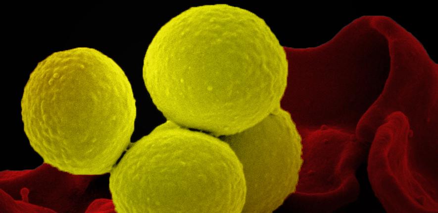 Scanning electron micrograph of a human neutrophil ingesting MRSA (yellow)