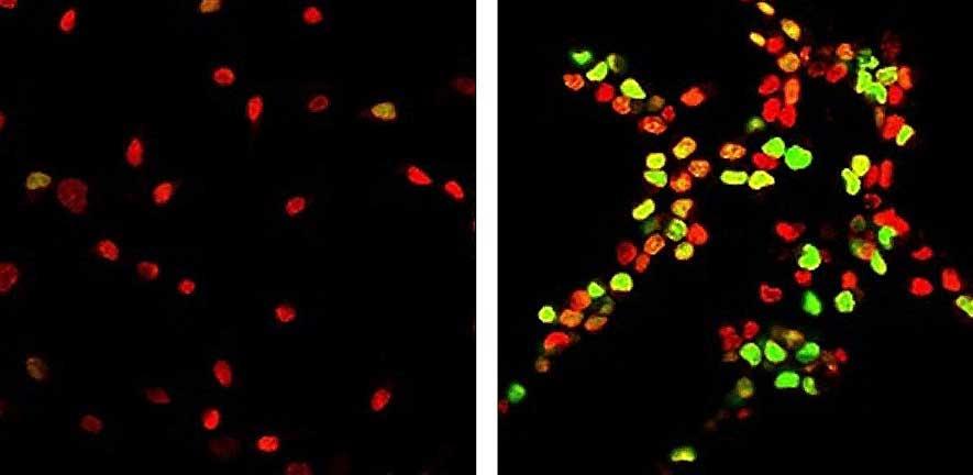 Aged rat brain stem cells grown on a soft surface (right) show more healthy, vigorous growth than similar aged brain stem cells grown on a stiff surface (left)