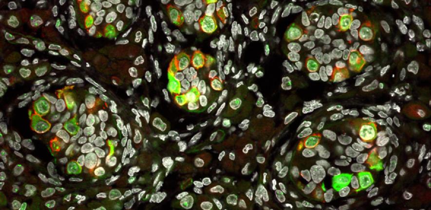 Developing human primordial germ cells (each small green and red cell is a PGC)