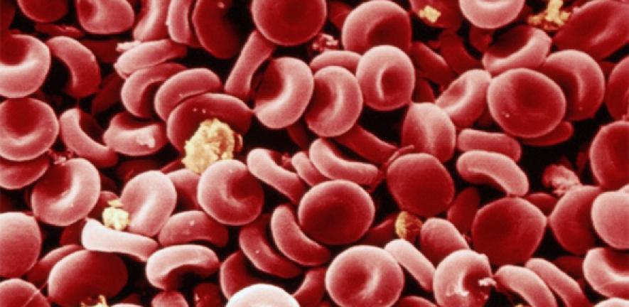 SEM image of normal red blood cells, computer-coloured red