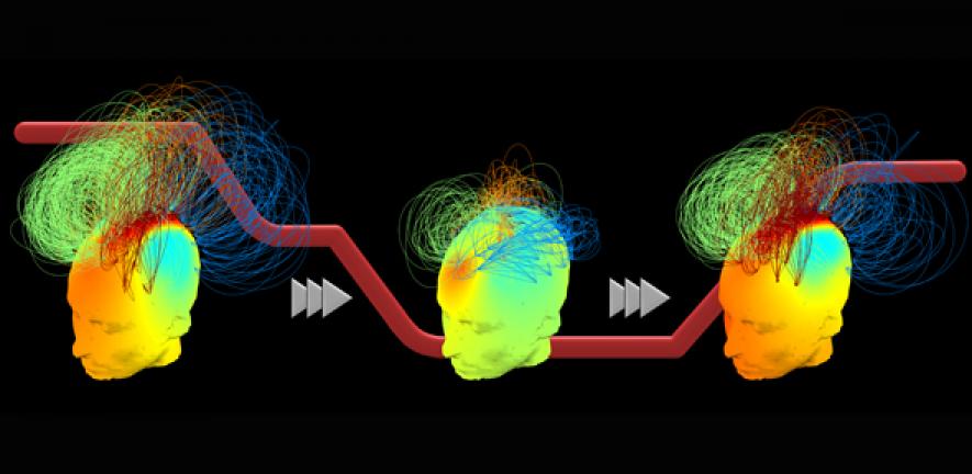 Brain networks during the transition to unconsciousness during propofol sedation