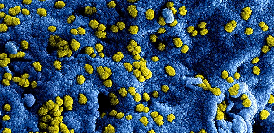 Close-up of virus molecule